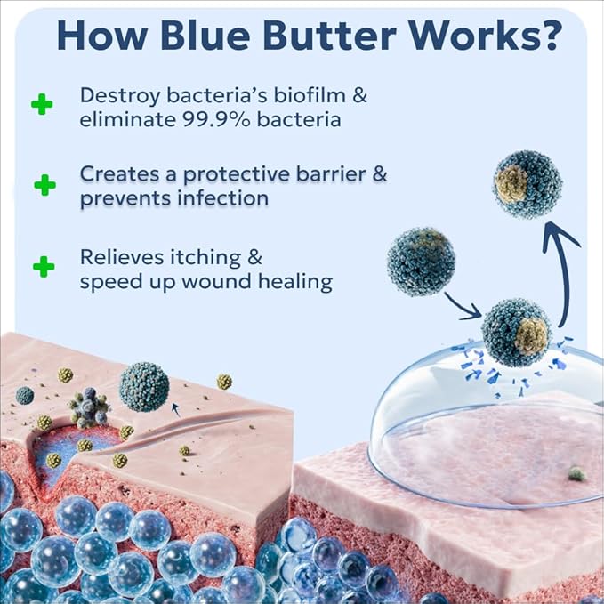 Forticept Blue Butter – Hot Spot Treatment for Dogs | Dog Wound Care | Skin Yeast Infections, Ringworm, Cuts, Rashes, First Aid Veterinary Strength Topical Ointment 4oz