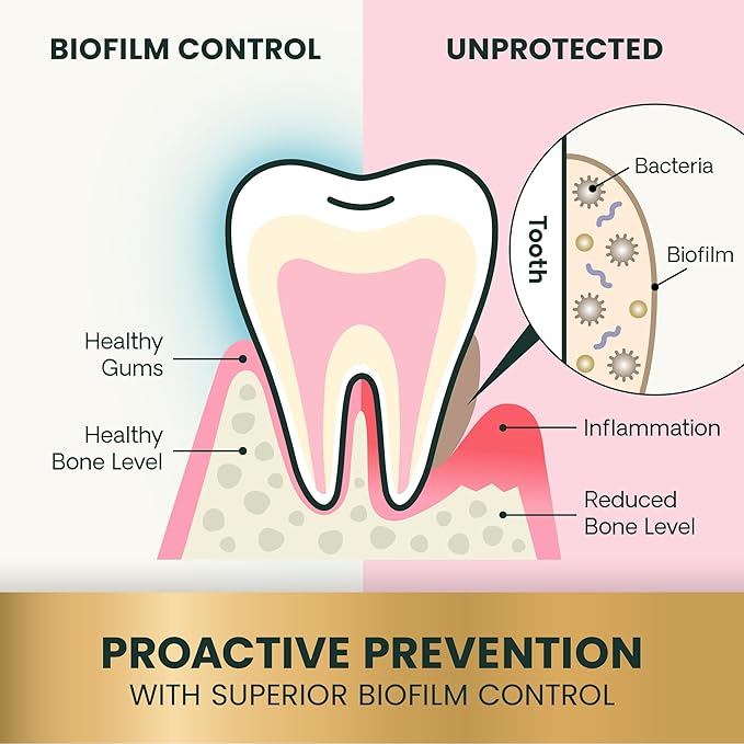 VetriScience Dental Care Powder, Perio Support Clinically Tested Dental Supplement for Small, Medium and Large Breed Dogs, Freshen Breath, Control Plaque and Tartar, Oral Health, 4.2 oz